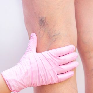 Favorisce una circolazione sana